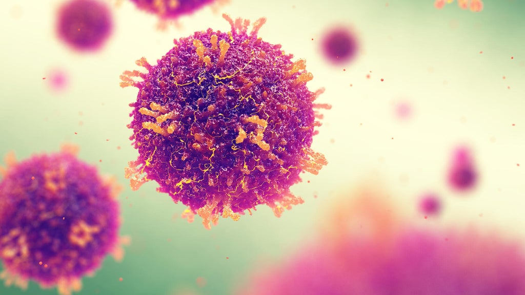 New measles cases in Macon County connected with previously reported infection, health officials say — Sandy Springs Health news
